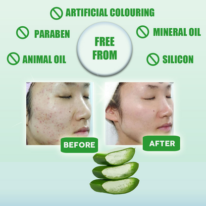 Elianto Calming & Moisture Organic Aloe Vera Moist Gel